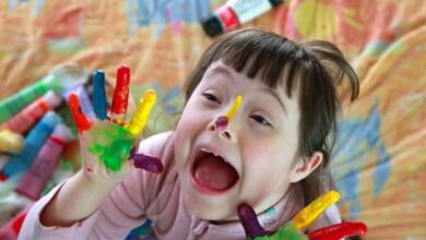 طفل داون طبيعي